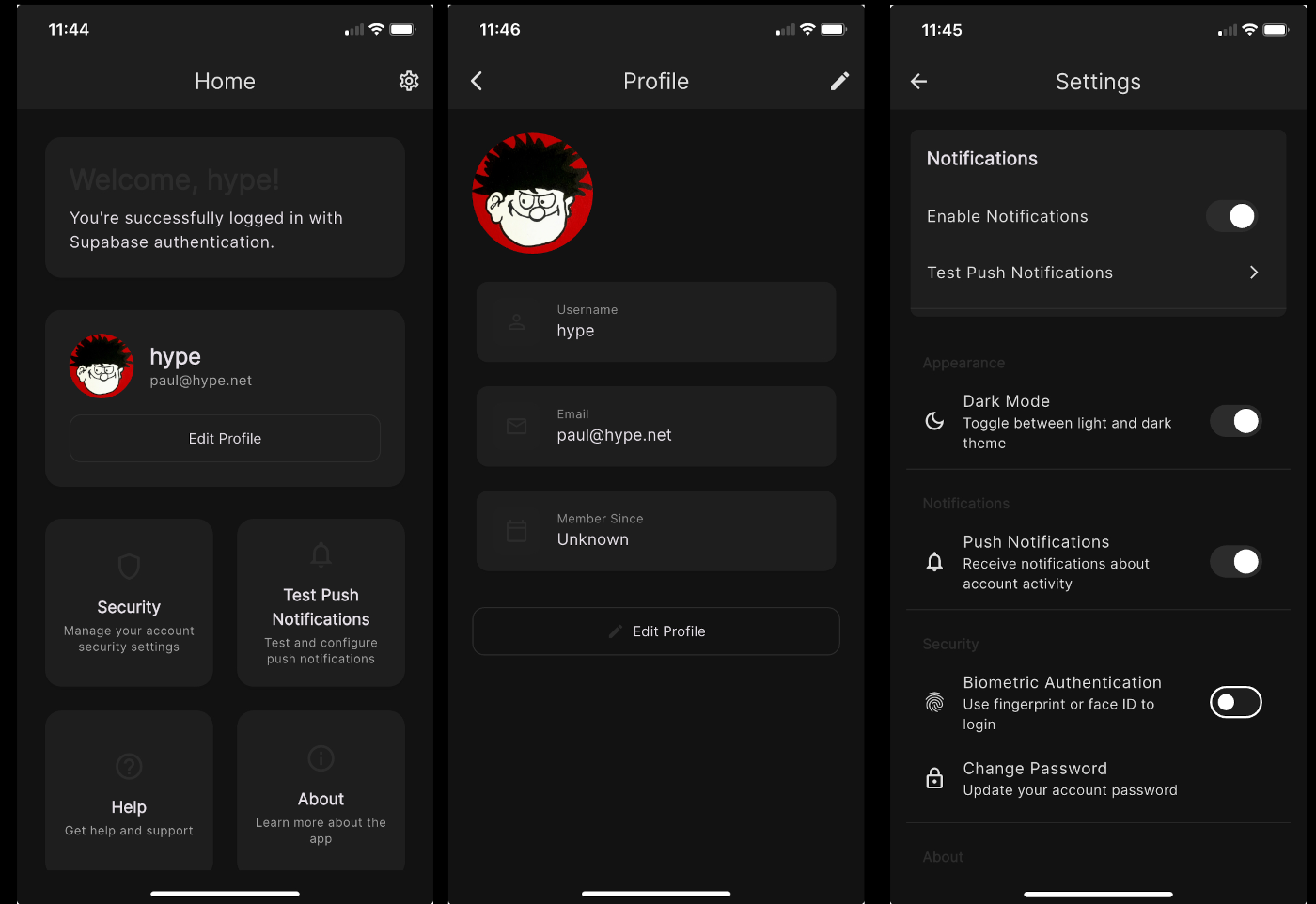 Self-hosted Supabase Auth